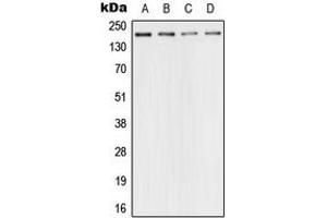 Western blot analysis of 53BP1 expression in HeLa (A), SP2/0 (B), PC12 (C), rat kidney (D) whole cell lysates. (TP53BP1 抗体  (N-Term))