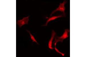 ABIN6273923 staining A549 by IF/ICC. (CCKBR 抗体  (N-Term))