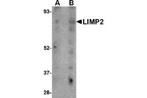 Western Blotting (WB) image for anti-Scavenger Receptor Class B, Member 2 (SCARB2) (C-Term) antibody (ABIN1030483) (SCARB2 抗体  (C-Term))