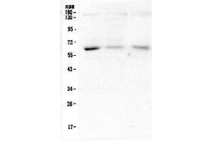 Western blot analysis of ARSA using anti-ARSA antibody (ABIN5692787).