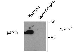 Western blots of HEK293 cells transfected with Parkin WT (Phospho) and Parkin S101 mutant (non-phospho) showing the phospho-specific immunolabeling of the ~ 52 k parkin protein. (Parkin 抗体  (pSer101))