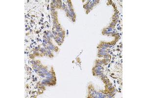 Immunohistochemistry of paraffin-embedded human lung using SPR antibody. (SPR 抗体)