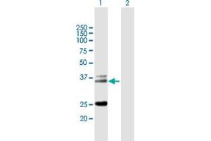 Western Blot analysis of TRA@ expression in transfected 293T cell line by TRA@ MaxPab polyclonal antibody. (TCR alpha 抗体  (AA 1-278))