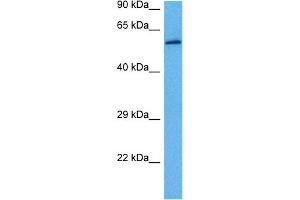 Host:  Rabbit  Target Name:  GLUD1  Sample Tissue:  Rat Skeletal Muscle  Antibody Dilution:  1ug/ml (GLUD1 抗体  (N-Term))