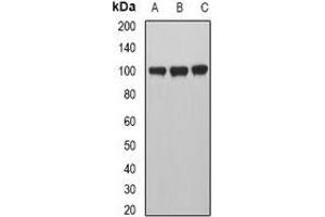 Western blot analysis of MVP expression in A549 (A), Hela (B), HepG2 (C) whole cell lysates. (MVP 抗体)