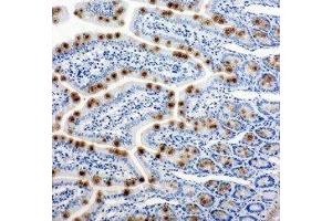 Anti-Hsp105 antibody, IHC(P) IHC(P): Rat Intestine Tissue (HSPH1 抗体  (C-Term))