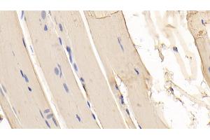 Immunohistochemistry (IHC) image for anti-Myoglobin (MB) (AA 1-154) antibody (ABIN7443728)