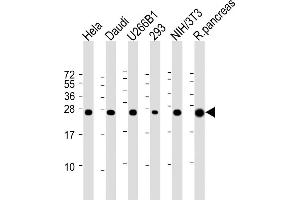 All lanes : Anti-RPL10 Antibody (N-term) at 1:2000 dilution Lane 1: Hela whole cell lysate Lane 2: Daudi whole cell lysate Lane 3: U266B1 whole cell lysate Lane 4: 293 whole cell lysate Lane 5: NIH/3T3 whole cell lysate Lane 6: Rat pancreas lysate Lysates/proteins at 20 μg per lane. (RPL10 抗体  (N-Term))