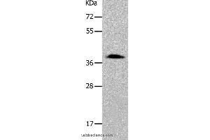 Western blot analysis of 293T cell, using PARD6A Polyclonal Antibody at dilution of 1:700 (PARD6A 抗体)