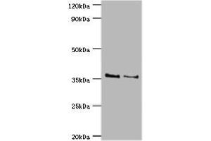 Western blot All lanes: HOXA1 antibody at 2 μg/mL Lane 1: NIH/3T3 whole cell lysate Lane 2: Hela whole cell lysate Secondary Goat polyclonal to rabbit IgG at 1/10000 dilution Predicted band size: 37, 15, 25 kDa Observed band size: 37 kDa (HOXA1 抗体  (AA 75-205))
