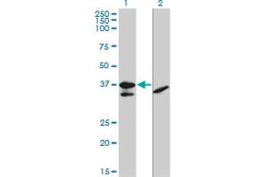 Western Blot analysis of TCF19 expression in transfected 293T cell line by TCF19 monoclonal antibody (M01), clone 6D8. (TCF19 抗体  (AA 17-102))
