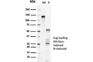 SDS-PAGE Analysis Purified p57 Recombinant Rabbit Monoclonal Antibody (KIP2/7083R). (Recombinant CDKN1C 抗体)