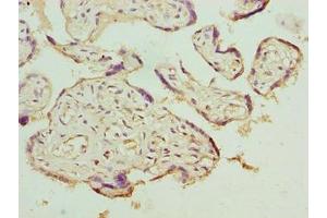 Immunohistochemistry of paraffin-embedded human placenta tissue using ABIN7158182 at dilution of 1:100 (LRRC42 抗体  (AA 201-428))
