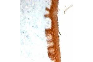 Formalin-fixed, paraffin-embedded human skin stained with Keratin 10 antibody (KRT10/844). (Keratin 10 抗体)
