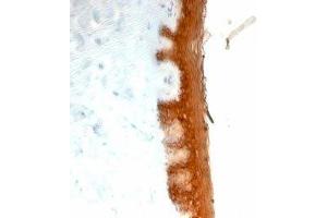 Formalin-fixed, paraffin-embedded human skin stained with Keratin 10 antibody (KRT10/844).