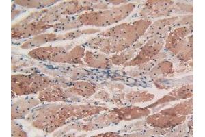 Immunohistochemistry (IHC) image for anti-Actin, alpha 2, Smooth Muscle, Aorta (ACTA2) (AA 167-377) antibody (ABIN7439306)