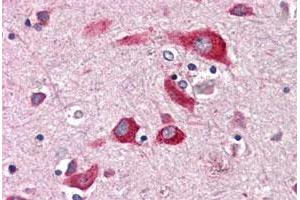 Immunohistochemical staining of human brain, cortex with ENTPD2 polyclonal antibody . (ENTPD2 抗体  (Internal Region))