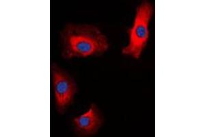 Immunofluorescent analysis of Amylin staining in HeLa cells. (Amylin/DAP 抗体  (N-Term))