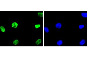 SHG-44 cells were fixed in paraformaldehyde, permeabilized with 0. (HDAC2 抗体)