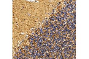 IHC analysis of Drebrin/DBN1 using anti-Drebrin/DBN1 antibody (ABIN7602638).