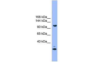 WB Suggested Anti-STARD8 Antibody Titration: 1. (STARD8 抗体  (N-Term))