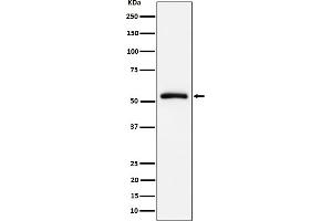 Western blot analysis of CAP1 expression in Raji cell lysate. (Recombinant CAP1 抗体)