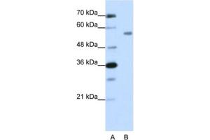 Western Blotting (WB) image for anti-Zinc Finger Protein 497 (ZNF497) antibody (ABIN2462019) (ZNF497 抗体)
