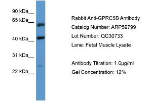 WB Suggested Anti-GPRC5B  Antibody Titration: 0. (GPRC5B 抗体  (N-Term))