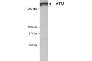 Western blot analysis of ATM in HeLa whole cell lysate using ATM polyclonal antibody . (ATM 抗体  (C-Term))