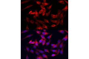 Immunofluorescence (IF) image for anti-Collagen, Type III, alpha 1 (COL3A1) (AA 1217-1466) antibody (ABIN1679317)