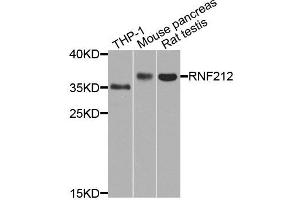 Western blot analysis of extract of various cells, using RNF212 antibody. (RNF212 抗体)