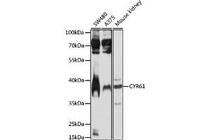 Western blot analysis of extracts of various cell lines, using CYR61 antibody (ABIN1872182) at 1:1000 dilution. (CYR61 抗体)