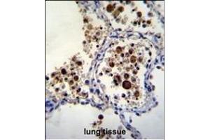 SIGLEC15 Antibody (C-term) (ABIN655450 and ABIN2844979) immunohistochemistry analysis in formalin fixed and paraffin embedded human lung tissue followed by peroxidase conjugation of the secondary antibody and DAB staining.