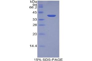 SDS-PAGE analysis of Human LEAP2 Protein. (Liver Expressed Antimicrobial Peptide 2 (LEAP2) Peptide)