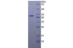 SDS-PAGE analysis of Human MMP24 Protein. (MMP24 蛋白)