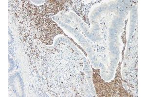 Image no. 1 for anti-Interleukin 5 (IL5) antibody (ABIN465636) (IL-5 抗体)