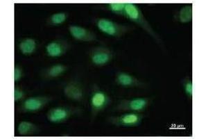 Immunostaining analysis in HeLa cells. (ID1 抗体)