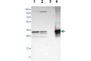 Western blot analysis of Lane 1: Human cell line RT-4, Lane 2: Human cell line U-251MG sp, Lane 3: Human plasma (IgG/HSA depleted), Lane 4: Human liver tissue with TST polyclonal antibody  at 1:100-1:250 dilution. (TST 抗体)