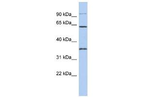 WB Suggested Anti-FAM71B Antibody Titration: 0. (FAM71B 抗体  (Middle Region))