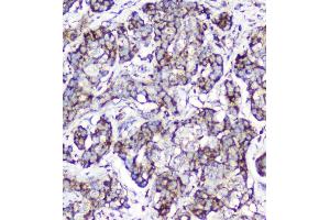 IHC analysis of Cytochrome C using anti-Cytochrome C antibody (ABIN5693008).
