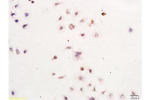 Immunohistochemistry (Paraffin-embedded Sections) (IHC (p)) image for anti-Baculoviral IAP Repeat-Containing 5 (BIRC5) (AA 85-142) antibody (ABIN670911)