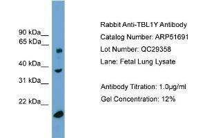 WB Suggested Anti-TBL1Y  Antibody Titration: 0. (TBL1Y 抗体  (Middle Region))