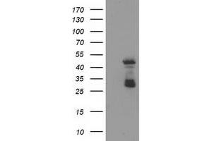 Western Blotting (WB) image for anti-ELK3, ETS-Domain Protein (SRF Accessory Protein 2) (ELK3) antibody (ABIN1498005) (ELK3 抗体)
