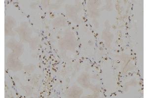 Immunohistochemistry (IHC) image for anti-Protein Phosphatase 1, Catalytic Subunit, alpha Isoform (PPP1CA) (C-Term) antibody (ABIN6264379)