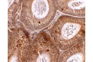 Immunohistochemistry of SPINK2 in mouse testis tissue with SPINK2 antibody at 2. (SPINK2 抗体  (C-Term))