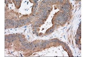 Immunohistochemical staining of paraffin-embedded Human liver tissue using anti-SNX9 mouse monoclonal antibody.