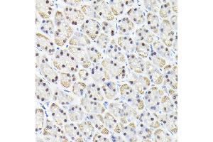 Immunohistochemistry (IHC) image for anti-Karyopherin alpha 3 (Importin alpha 4) (KPNA3) (AA 1-210) antibody (ABIN6142991)