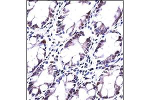 HRASLS5 Antibody (Center) ((ABIN657802 and ABIN2846775))immunohistochemistry analysis in formalin fixed and paraffin embedded human rectum tissue followed by peroxidase conjugation of the secondary antibody and DAB staining. (HRASLS5 抗体  (AA 100-129))