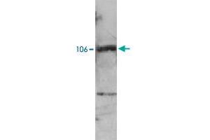 Western blot analysis of extracts from NB4 cells using PML polyclonal antibody . (PML 抗体)