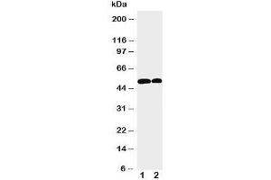 Western blot testing of NOXA1 antibody and Lane 1:  U87;  2: HeLa cell lysate.